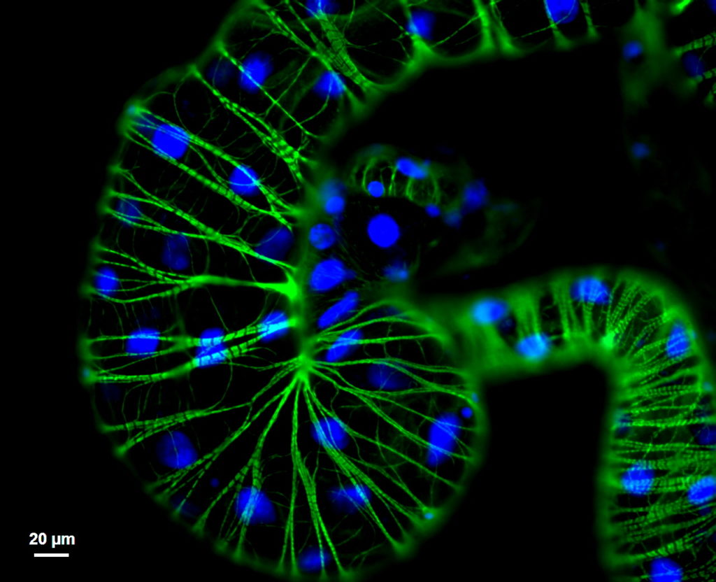  This image (a micro-rollercoaster) shows the amazing gut architecture of potato psyllid. Blue and green signals indicate the gut cell nuclei and actin filaments, respectively.